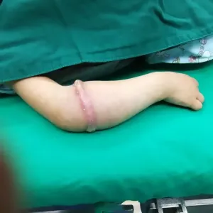 Avertisment medical pentru joaca cu elasticul