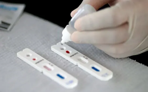 Valabilitate testului antigen rapid Covid-19 creşte la 48 de ore, de la 24 de ore