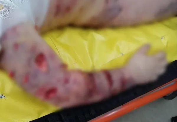 Apel de la Braşov pentru Aron, copilul mutilat de câini