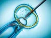 4.500 de euro de la stat, pentru fertilizare in vitro, până la 45 de ani