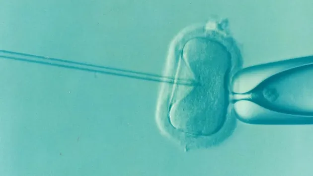 „Primul venit – primul servit”, în programul naţional de fertilizare in vitro