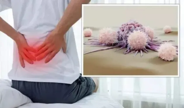 Durerea de spate: simptomul cancerului „tăcut”