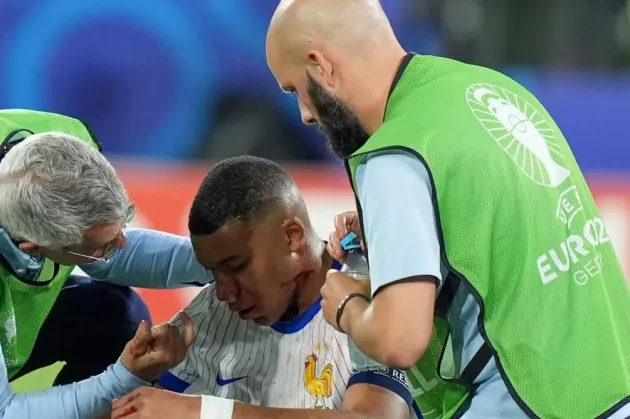 Kylian Mbappe şi-a spart nasul la primul meci