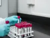 Laboratoarele care lucrează teste prelevate de la şoferi ar putea lucra şi sâmbăta şi duminica