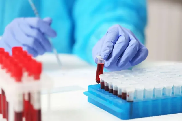 Un test de sânge poate detecta cancerul de colon. Analiza, autorizată deja în SUA