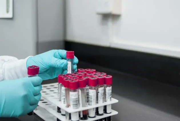 Laboratoarele care lucrează teste prelevate de la şoferi ar putea lucra şi sâmbăta şi duminica