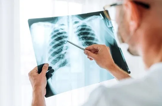 A crescut îngrijorător numărul cazurilor de cancer pulmonar la nefumători 