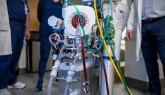 Tehnică avansată de susţinere a vieţii pentru pacienţii cardiaci din Braşov. Medicii, implicaţi în implementarea proiectului  care va aduce Judeţeanului primul ECMO