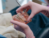 Aparat dentar metalic, ceramic sau invizibil: ghid pentru părinți
