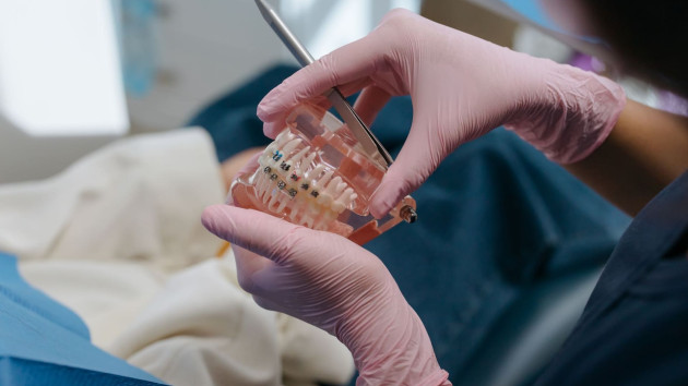 Aparat dentar metalic, ceramic sau invizibil: ghid pentru părinți

