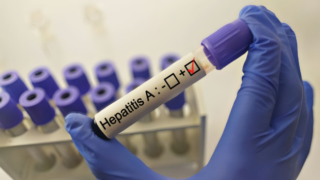 Focare de Hepatita A în Săcele, Tărlungeni, Zizin, Arini, Apața și Prejmer